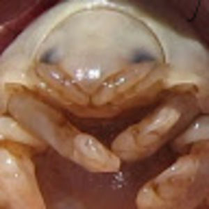Meet your Posher, Parasite